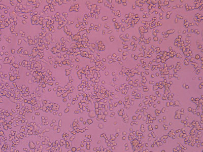 ��ϸ������������֤��������������ϸ�������ʴ� 90% ����������������������ϸ�����ʴ�95%����