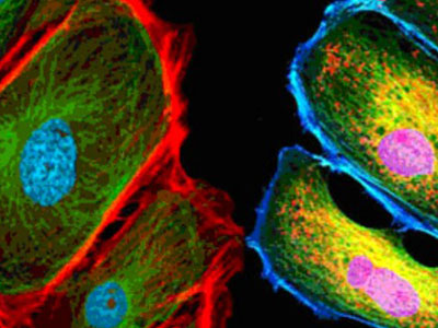 ���Ծ�ӫ������������������Ч����������������������ӫ����΢ʵ�顢���⹲�۽���΢ʵ�顢ӫ��ԭλ�ӽ���FISH���������΢ʵ���